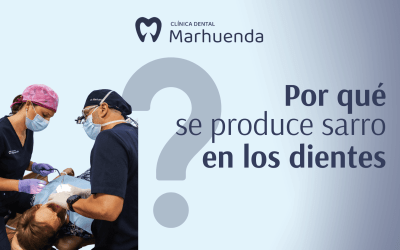 Por qué se produce sarro en los dientes