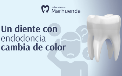 Un diente con endodoncia cambia de color