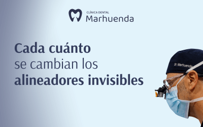Cada cuánto se cambian los alineadores invisibles
