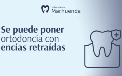 Se puede poner ortodoncia con encías retraídas