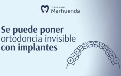 Se puede poner ortodoncia invisible con implantes​