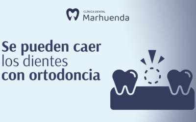 Se pueden caer los dientes con ortodoncia​