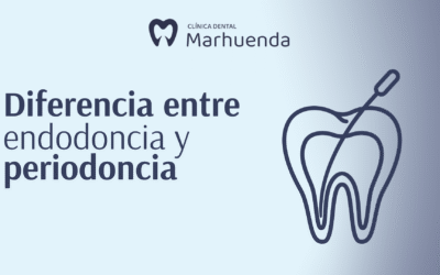 Diferencia entre endodoncia y periodoncia