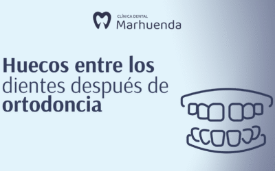 Huecos entre los dientes después de ortodoncia