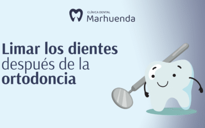 Limar dientes después de la ortodoncia