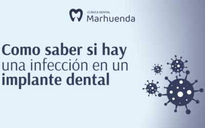 Como saber si hay infeccion en un implante dental​