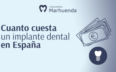 Cuanto cuesta un implante dental en España​