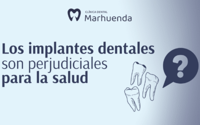 ¿Los implantes dentales son perjudiciales para la salud​?