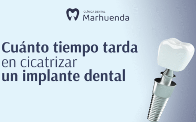 Cuanto tiempo tarda en cicatrizar un implante dental