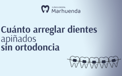 Cómo arreglar dientes apiñados sin ortodoncia