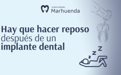 Hay que hacer reposo después de un implante dental