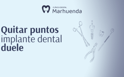 Quitar puntos implante dental duele