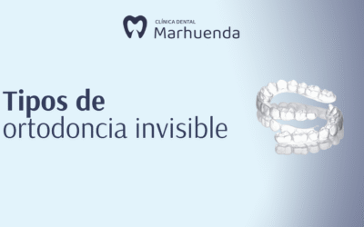 Tipos de ortodoncia invisible