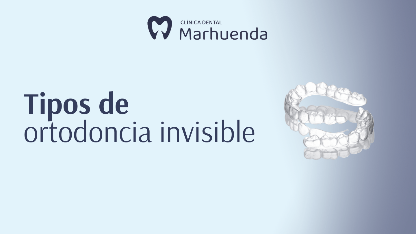 tipos de ortodoncia invisible