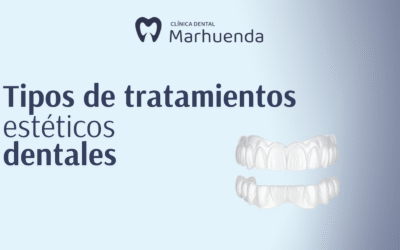 Tipos de tratamientos estéticos dentales