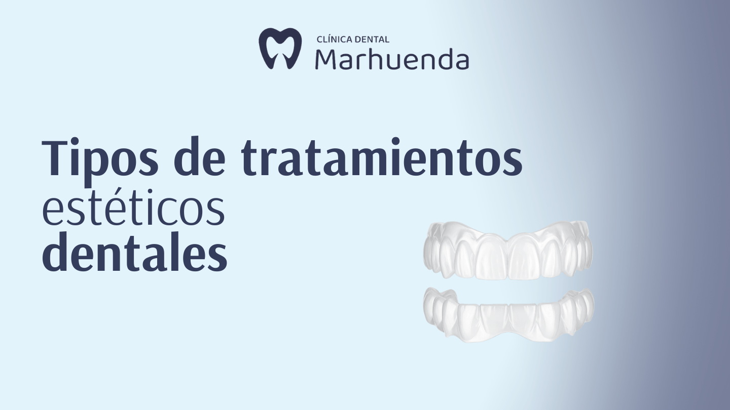 tipos de tratamientos estéticos dentales
