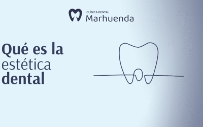 Qué es la estética dental