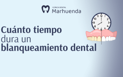 Blanqueamiento dental cuanto dura​