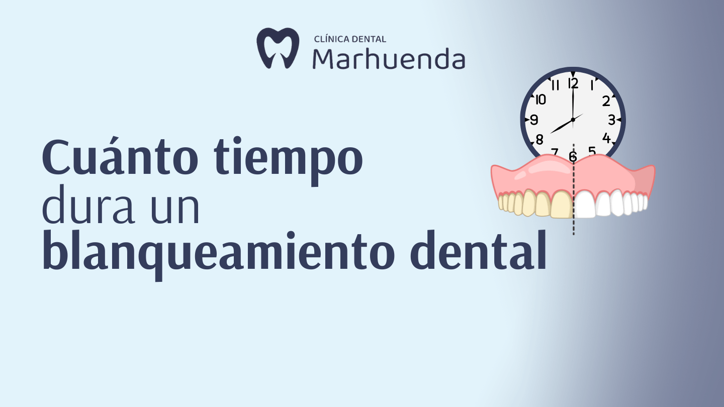 blanqueamiento dental cuanto dura​