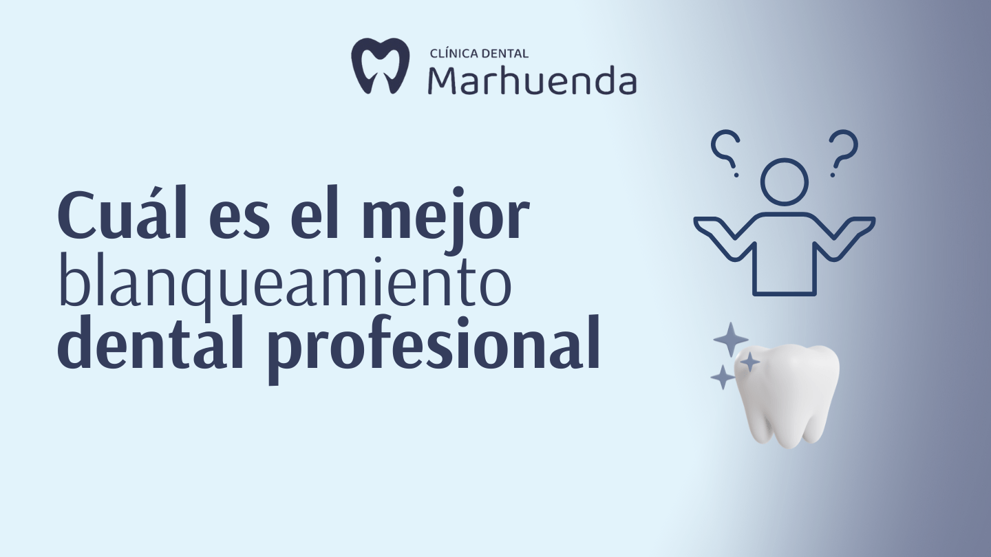 cual es el mejor blanqueamiento dental profesional​
