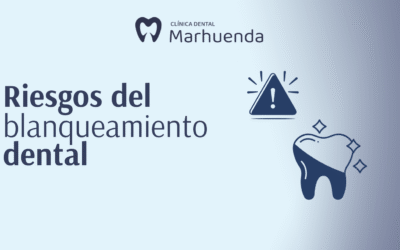 Riesgos del blanqueamiento dental