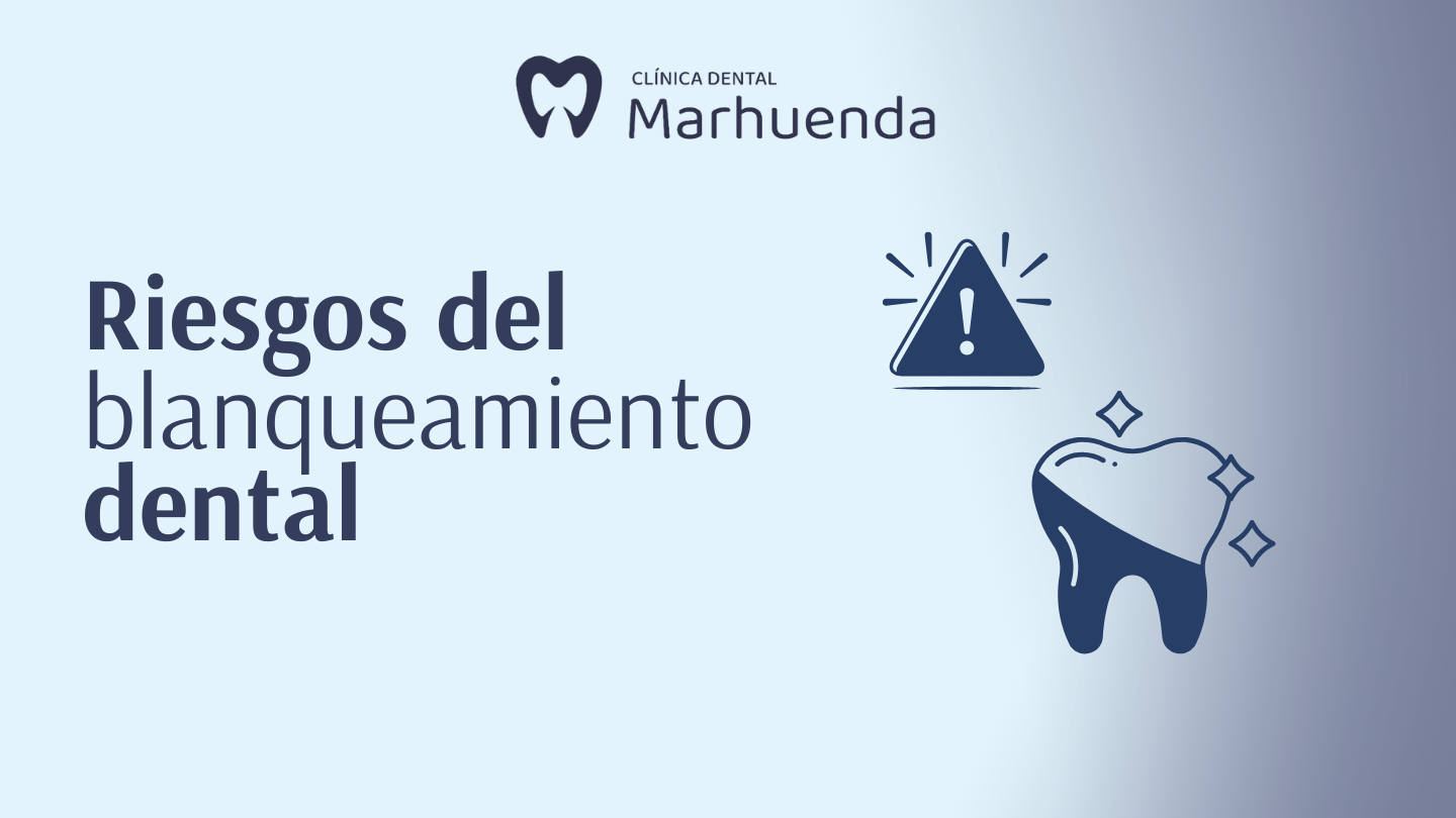 Riesgos del blanqueamiento dental