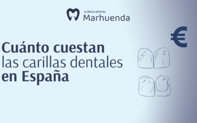 Cuánto cuestan las carillas dentales en España