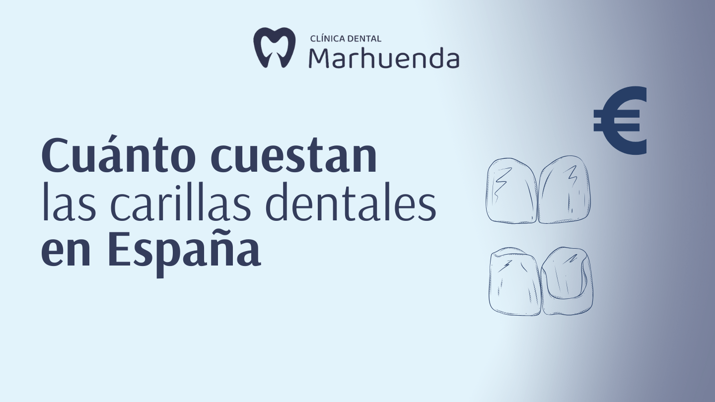 cuanto cuestan las carillas dentales en españa