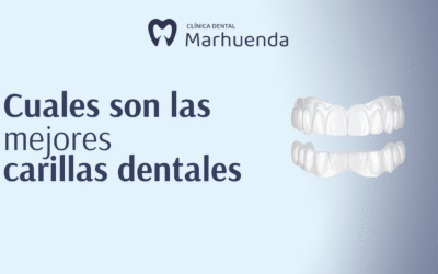 Cuales son las mejores carillas dentales