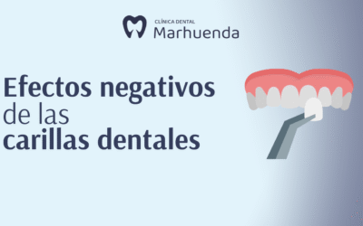 Efectos negativos de las carillas dentales