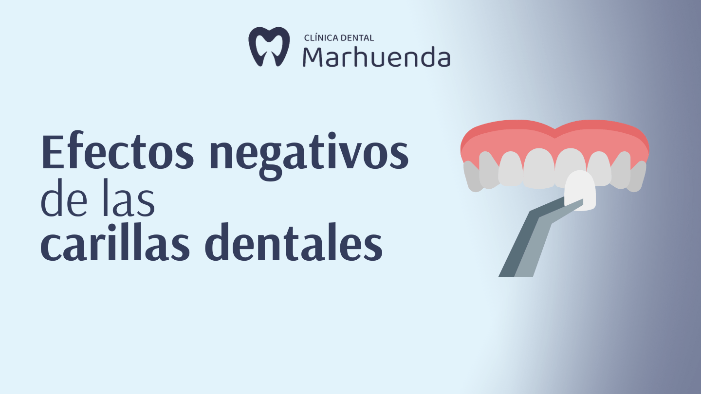 efectos negativos de las carillas dentales