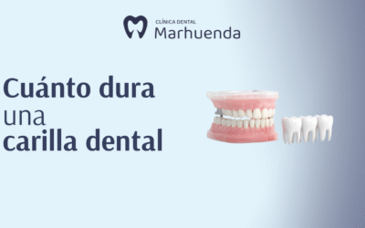 Cuánto dura una carilla dental