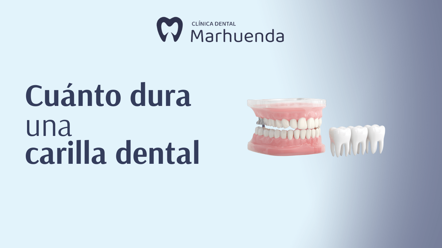 cuánto dura una carilla dental