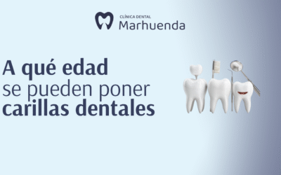 A que edad se pueden poner carillas dentales