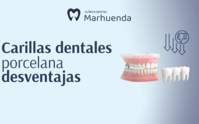 Carillas dentales porcelana desventajas