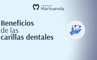 Beneficios de las carillas dentales