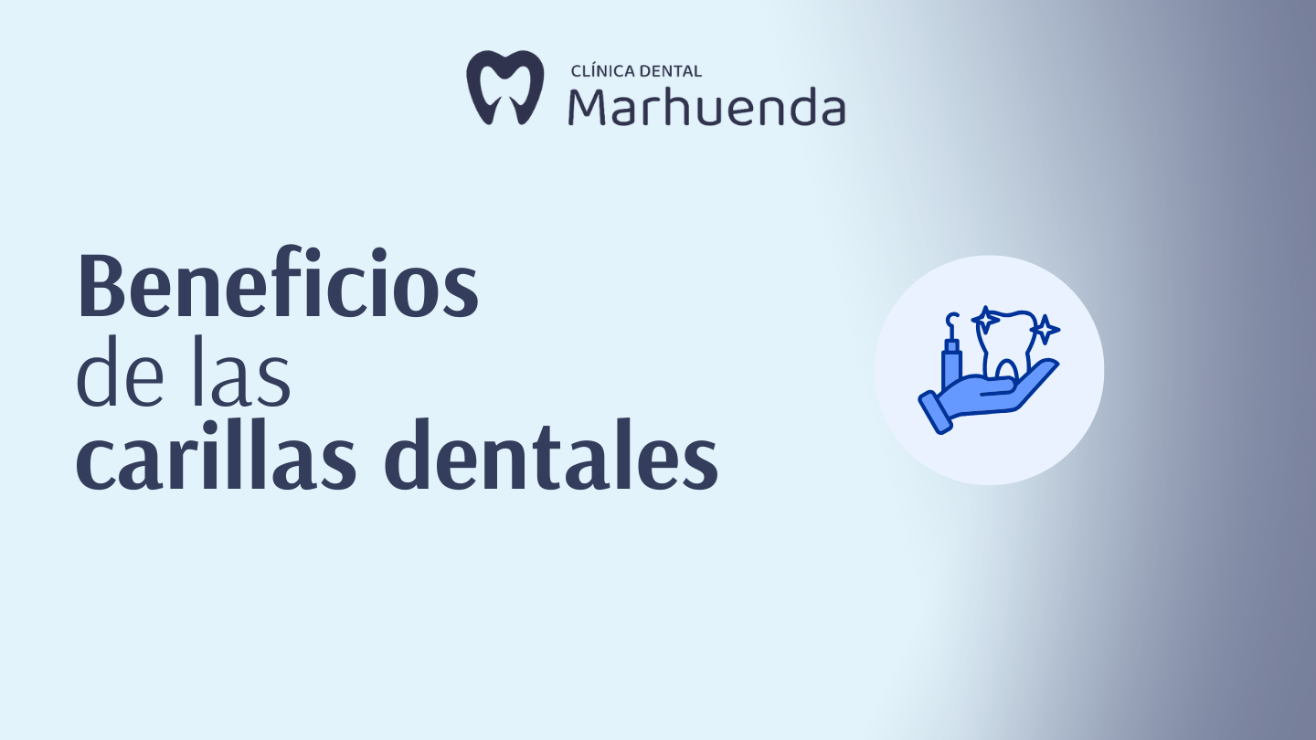 beneficios de las carillas dentales