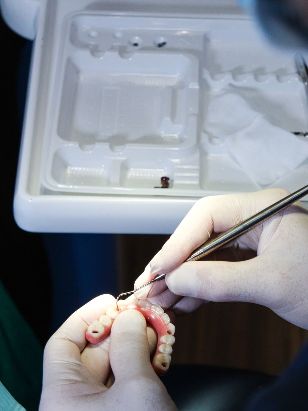 ortodoncia lingual alicante