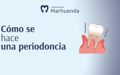 Cómo se hace una periodoncia