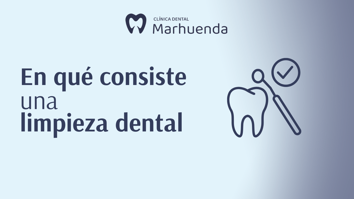 en que consiste una limpieza dental
