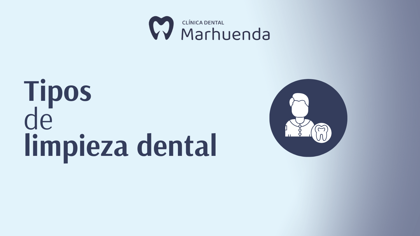 tipos de limpieza dental
