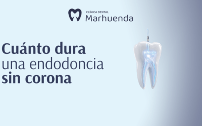 Cuánto dura una endodoncia sin corona​