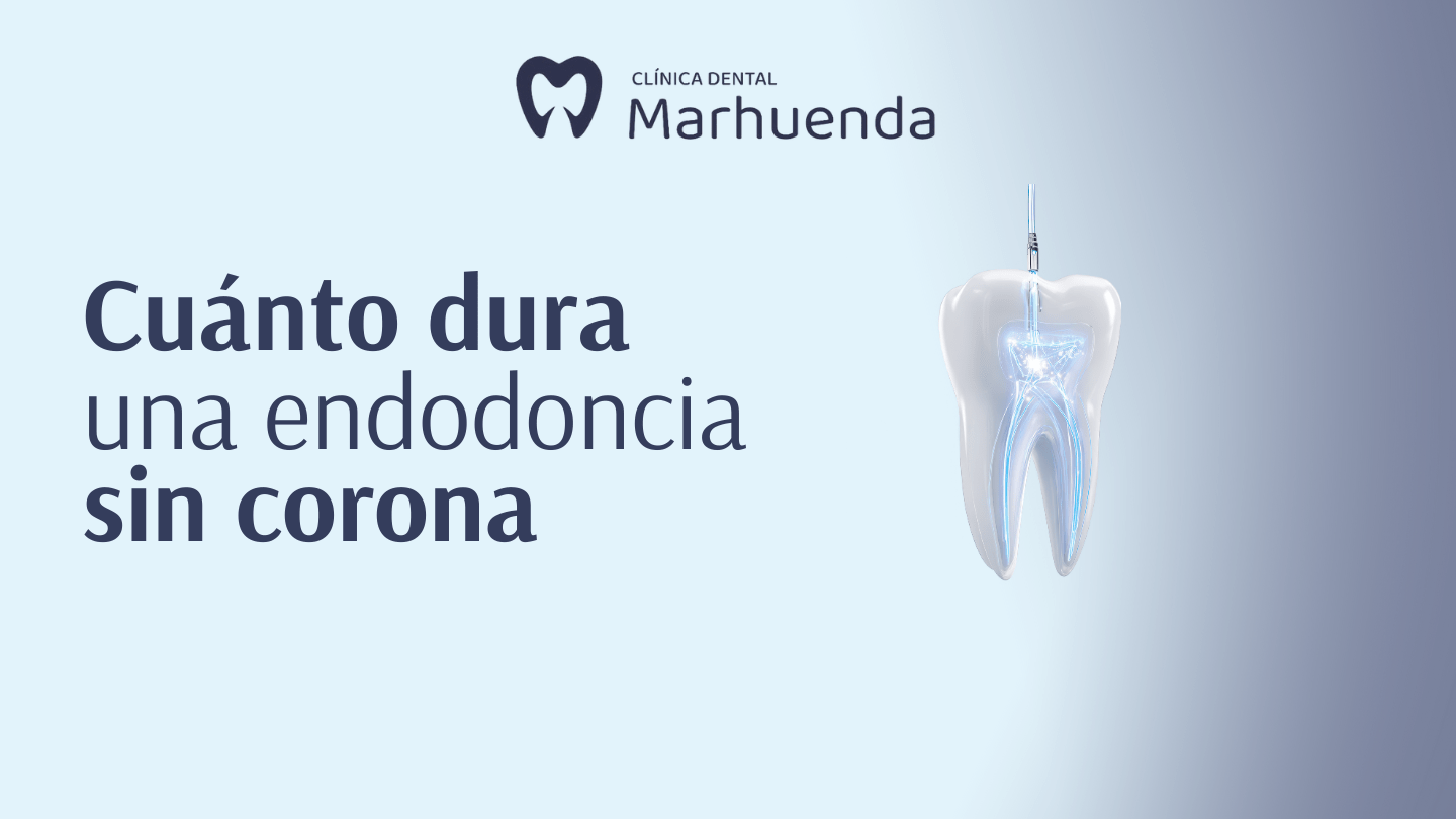 cuanto dura una endodoncia sin corona
