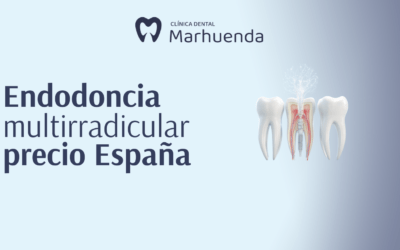 Endodoncia multirradicular precio España​
