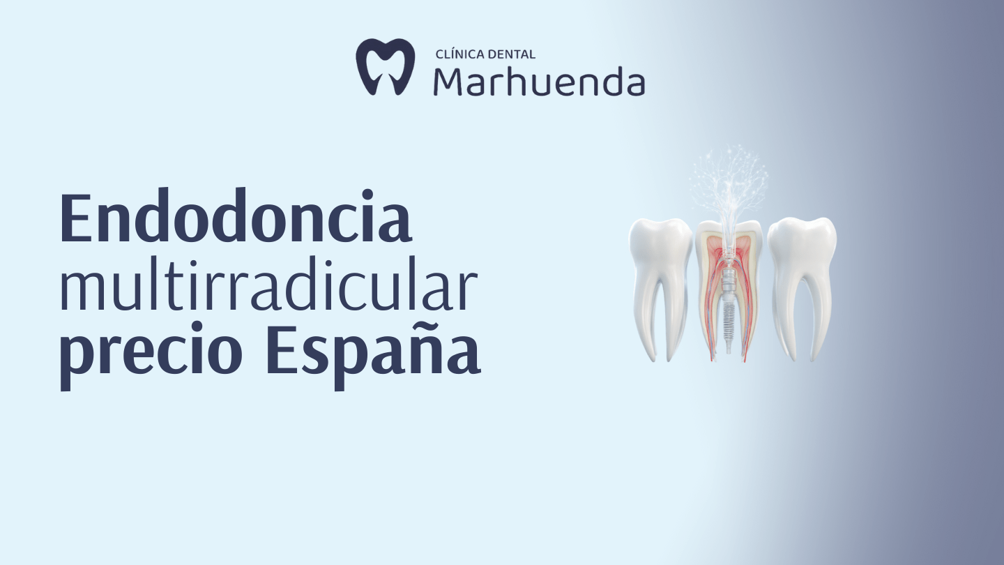 endodoncia multirradicular precio españa​