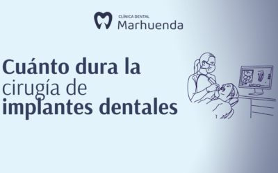 Cuánto dura la cirugía de implantes dentales