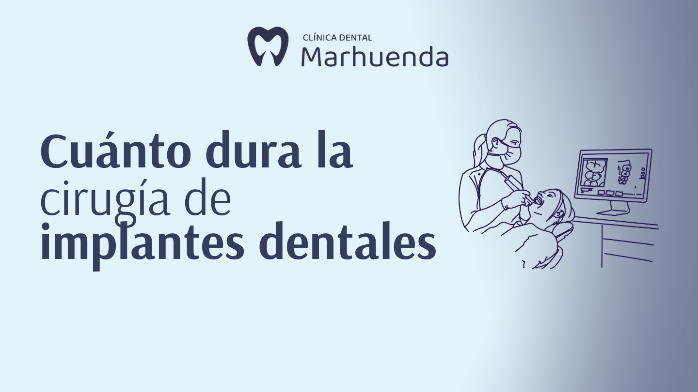 cuanto dura la cirugia de implantes dentales