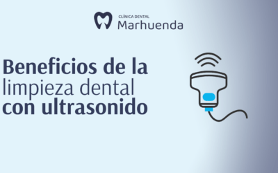 Beneficios de la limpieza dental con ultrasonido​