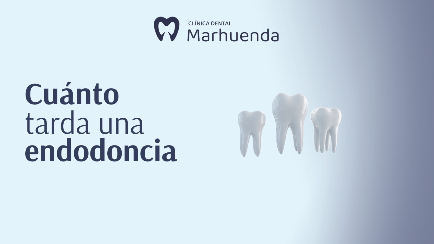 cuanto tarda una endodoncia