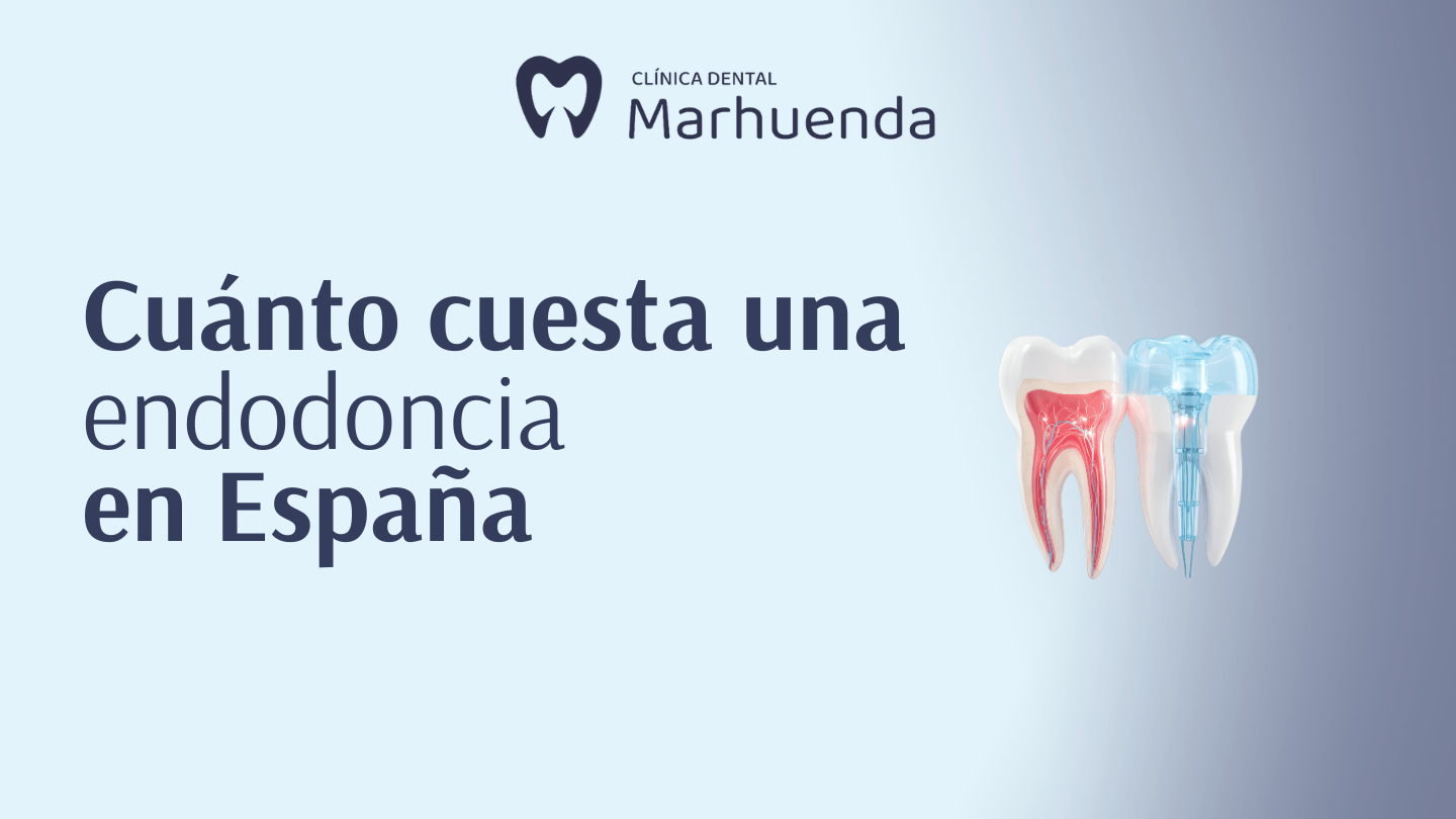 cuanto cuesta una endodoncia en españa​